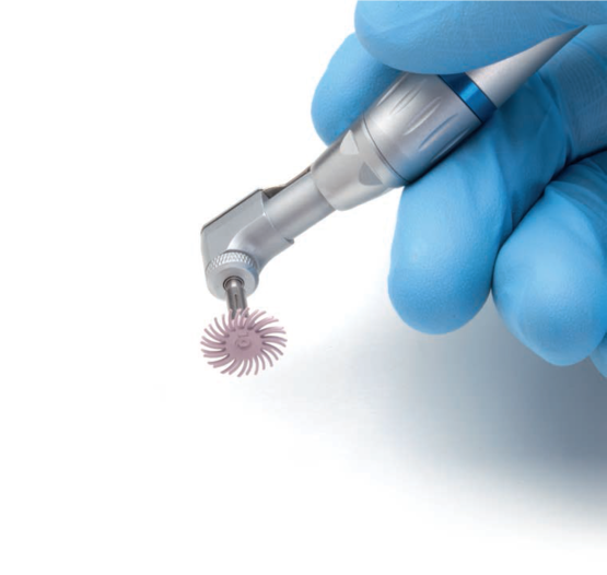 3M Soflex in der Anwendung