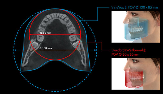 Dürr VistaVox S FoV