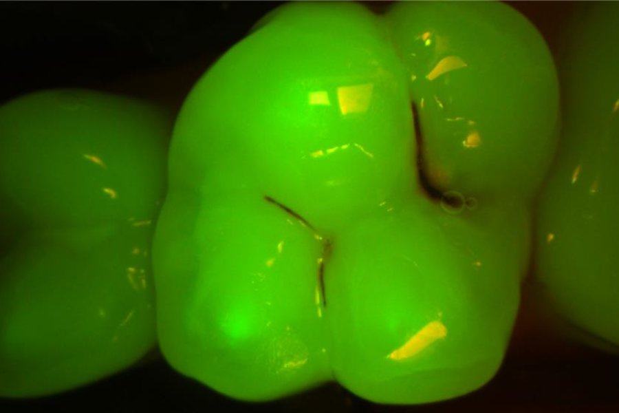 KaVo DIAGNOcam Vision Full HD Fluorescence