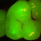 KaVo DIAGNOcam Vision Full HD Fluorescence