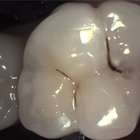 KaVo DIAGNOcam Vision Full HD Intraoral