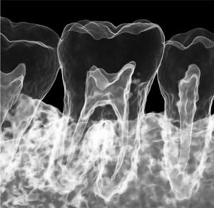 Green X von orangedental Endo Aufnahme