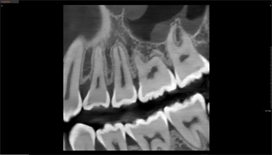 Green X von orangedental 2D Aufnahme